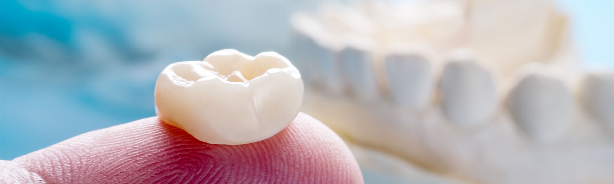 Porcelain Crowns Torrance CA