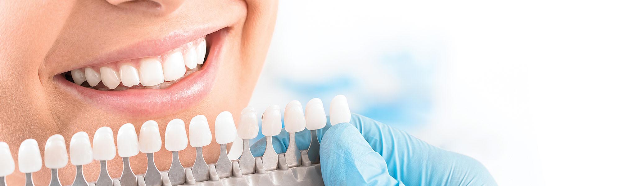 Porcelain Veneers Torrance CA