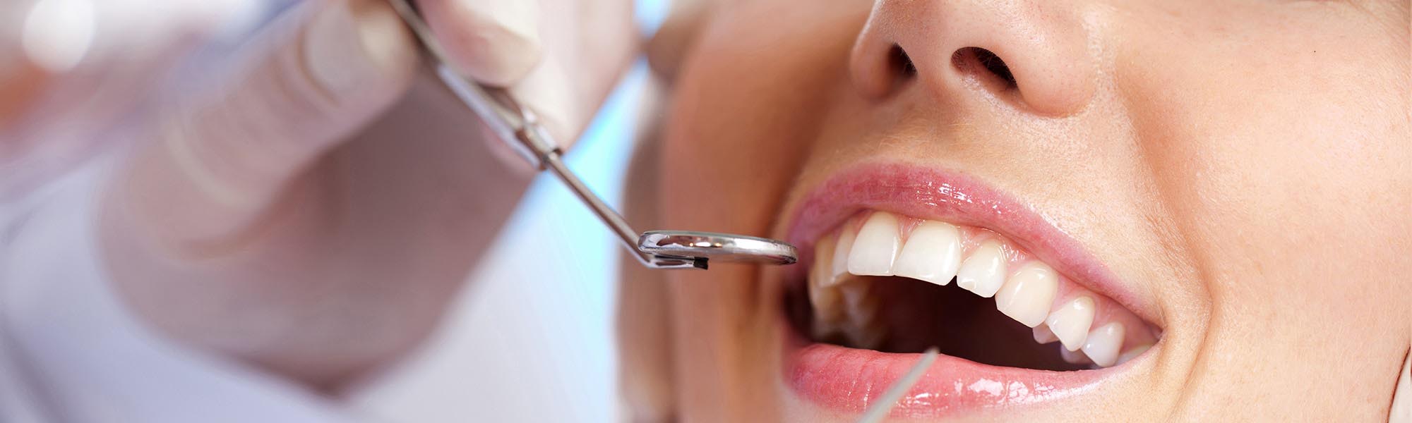 Tooth Extraction Torrance CA