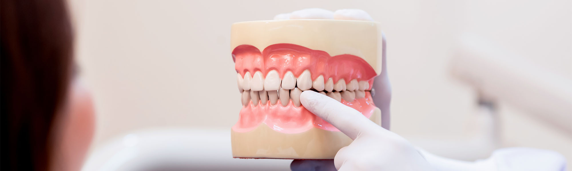 What is Dental Plaque? Torrance CA