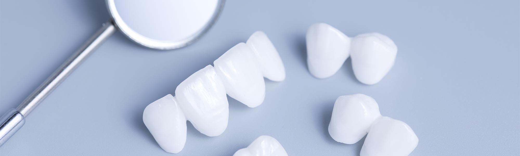 Porcelain Crowns in Torrance CA