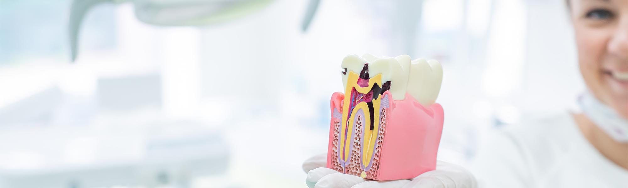 Dental Bonding Torrance CA