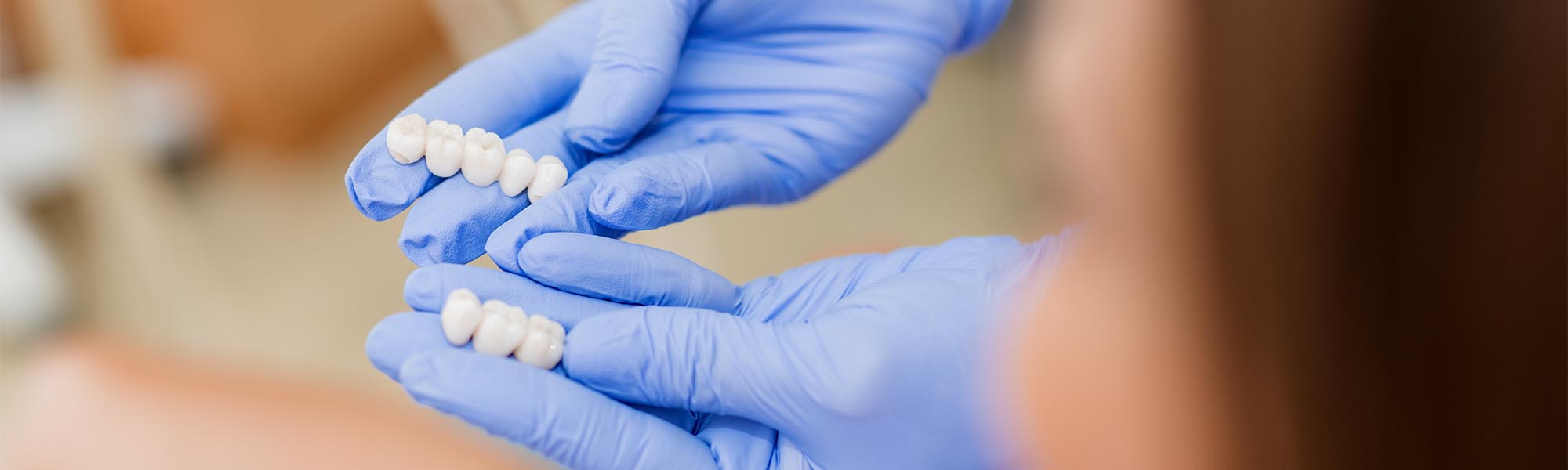 Dental Crowns Torrance CA