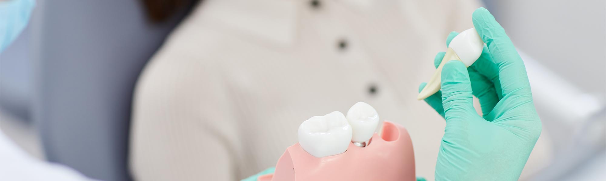 Teeth Extraction in Torrance CA