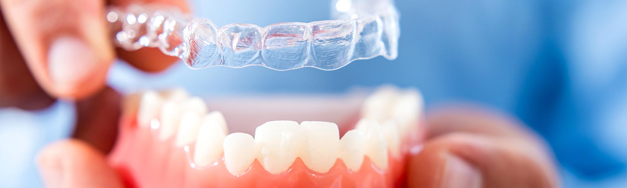 Invisalign® in Torrance CA