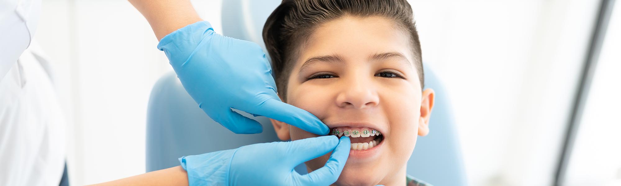 Metal Braces in Torrance CA