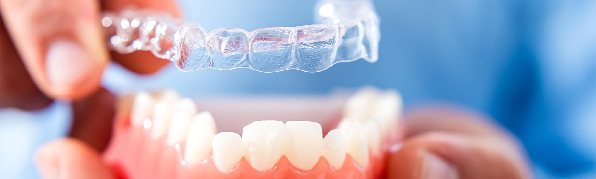 Orthodontics Dentist in Torrance CA