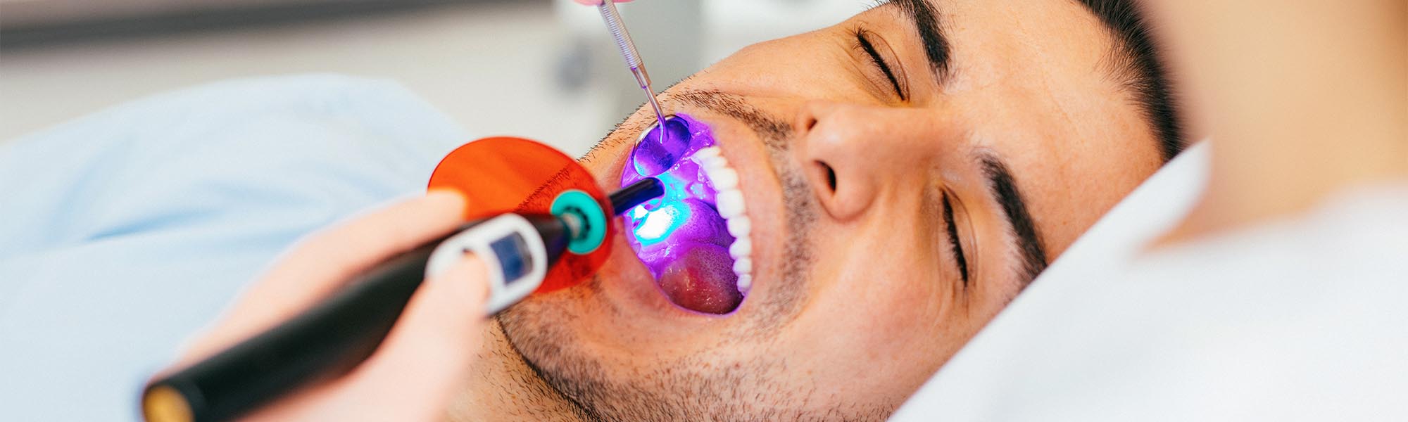 Dental Sealants in Torrance CA