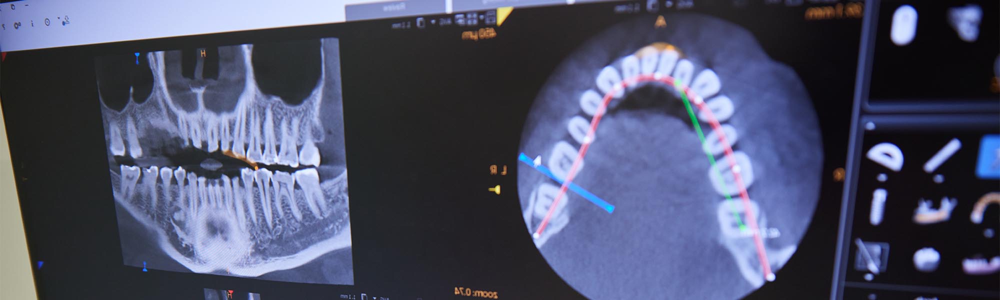 Innovative Dental Technology Torrance CA