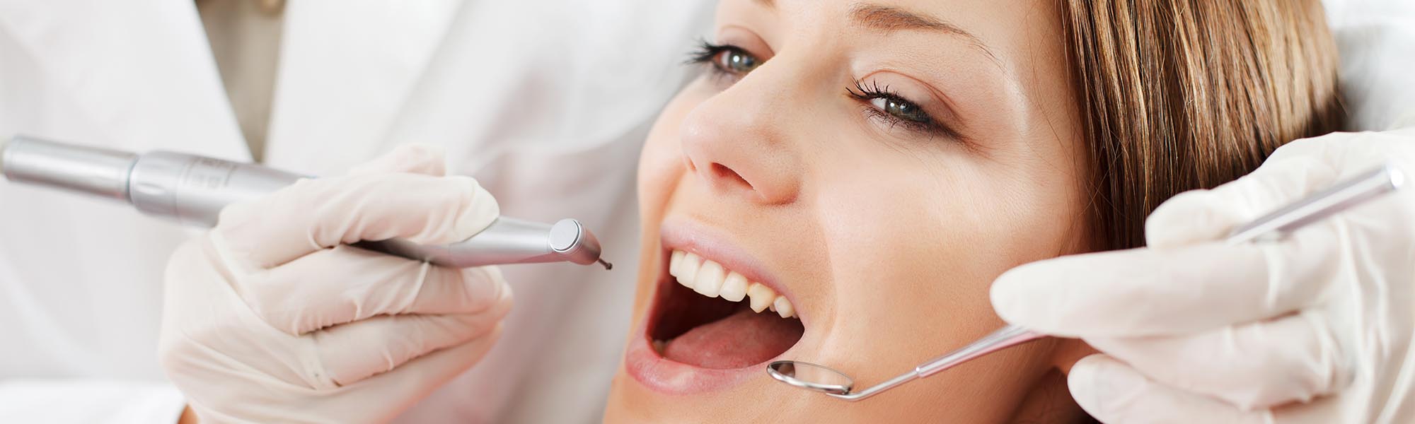 Routine Teeth Cleaning Torrance CA